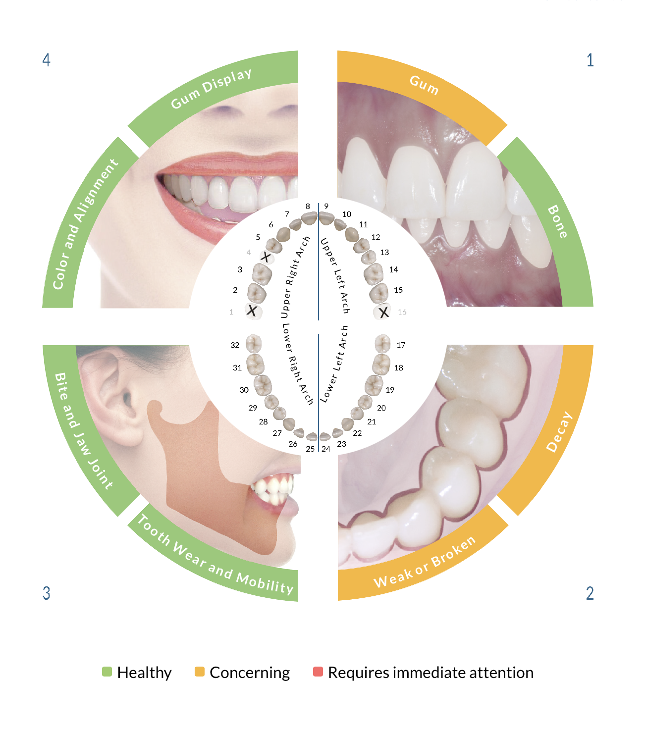 The True Wellness Score wheel: four dimensions of oral health color-coded green, orange, and red